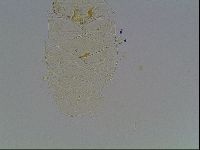 Echiniscus tessellatus image