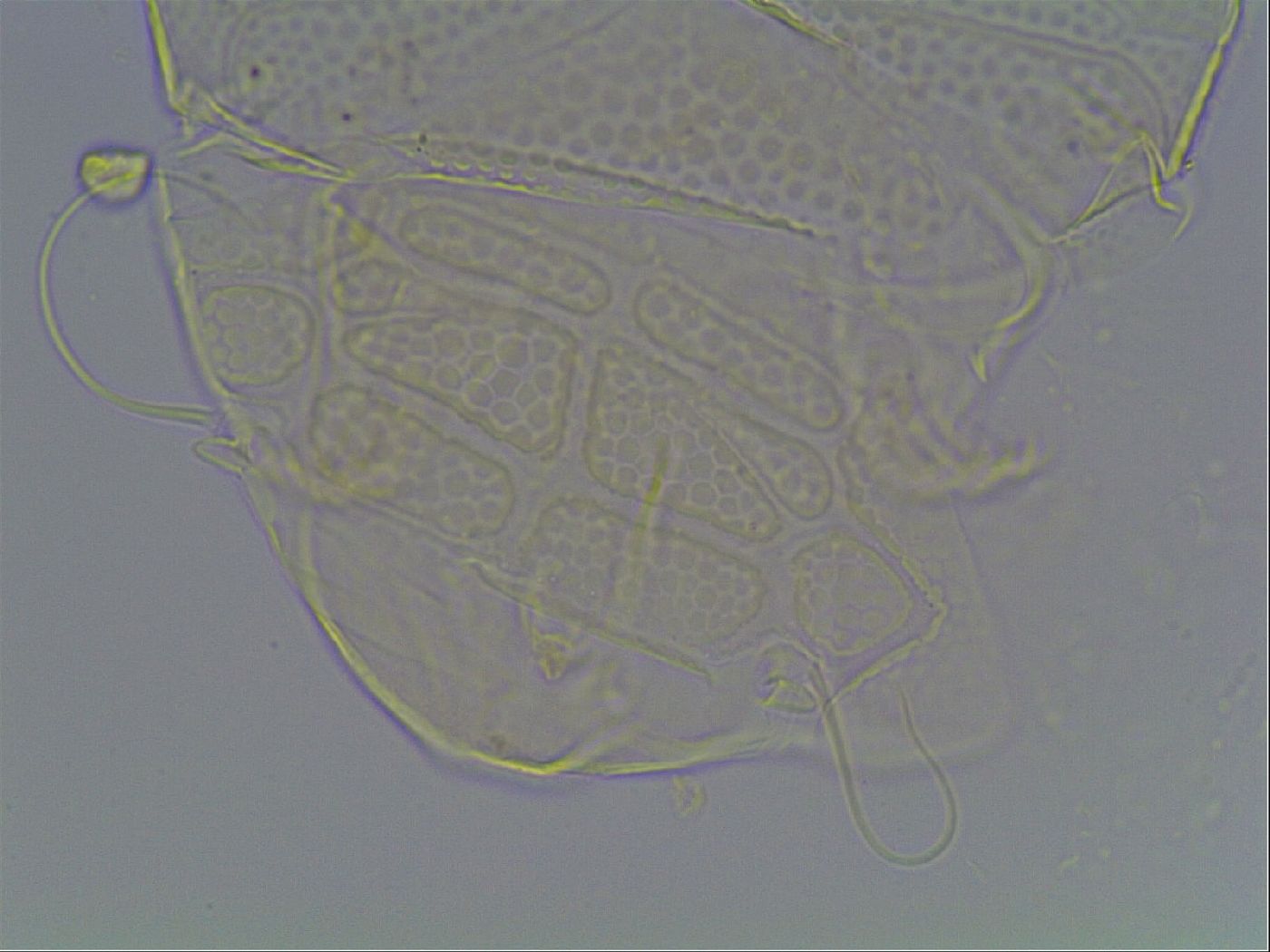 Echiniscus tessellatus image