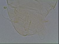 Echiniscus tessellatus image