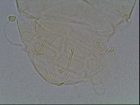 Media resource of Echiniscus tessellatus