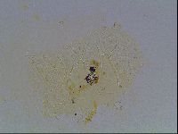 Echiniscus tessellatus image
