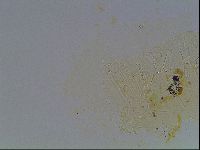 Echiniscus tessellatus image
