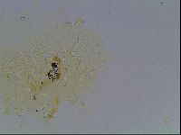Echiniscus tessellatus image