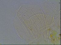 Echiniscus tessellatus image