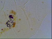 Echiniscus tessellatus image
