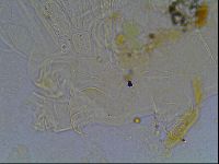 Echiniscus tessellatus image