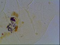 Echiniscus tessellatus image