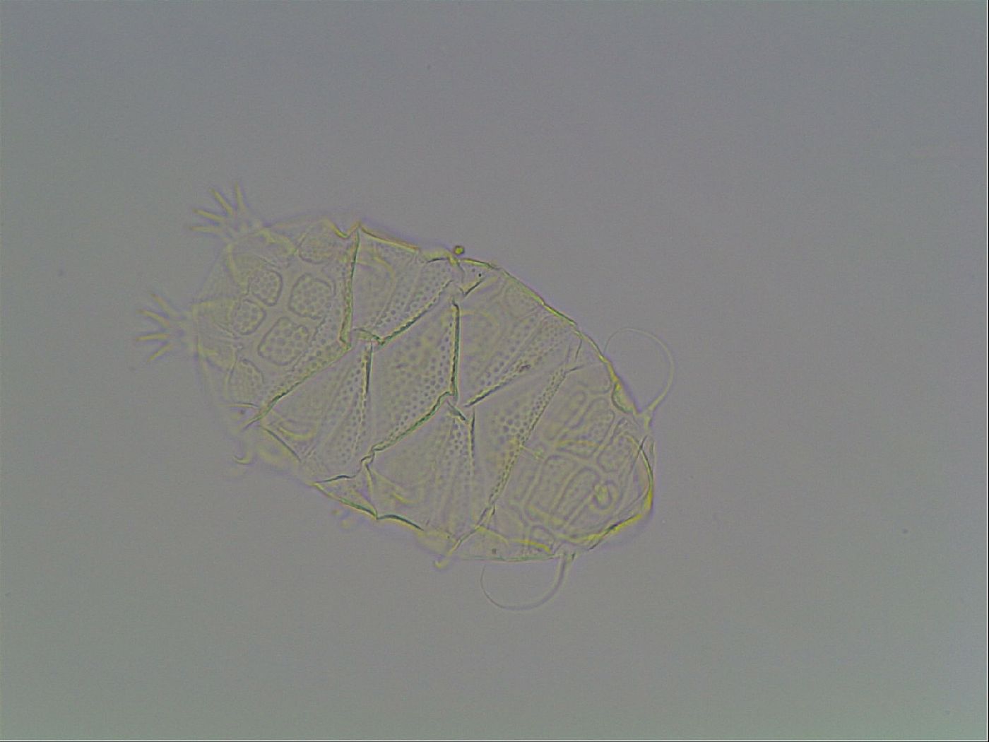 Echiniscus tessellatus image