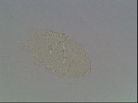 Echiniscus tessellatus image