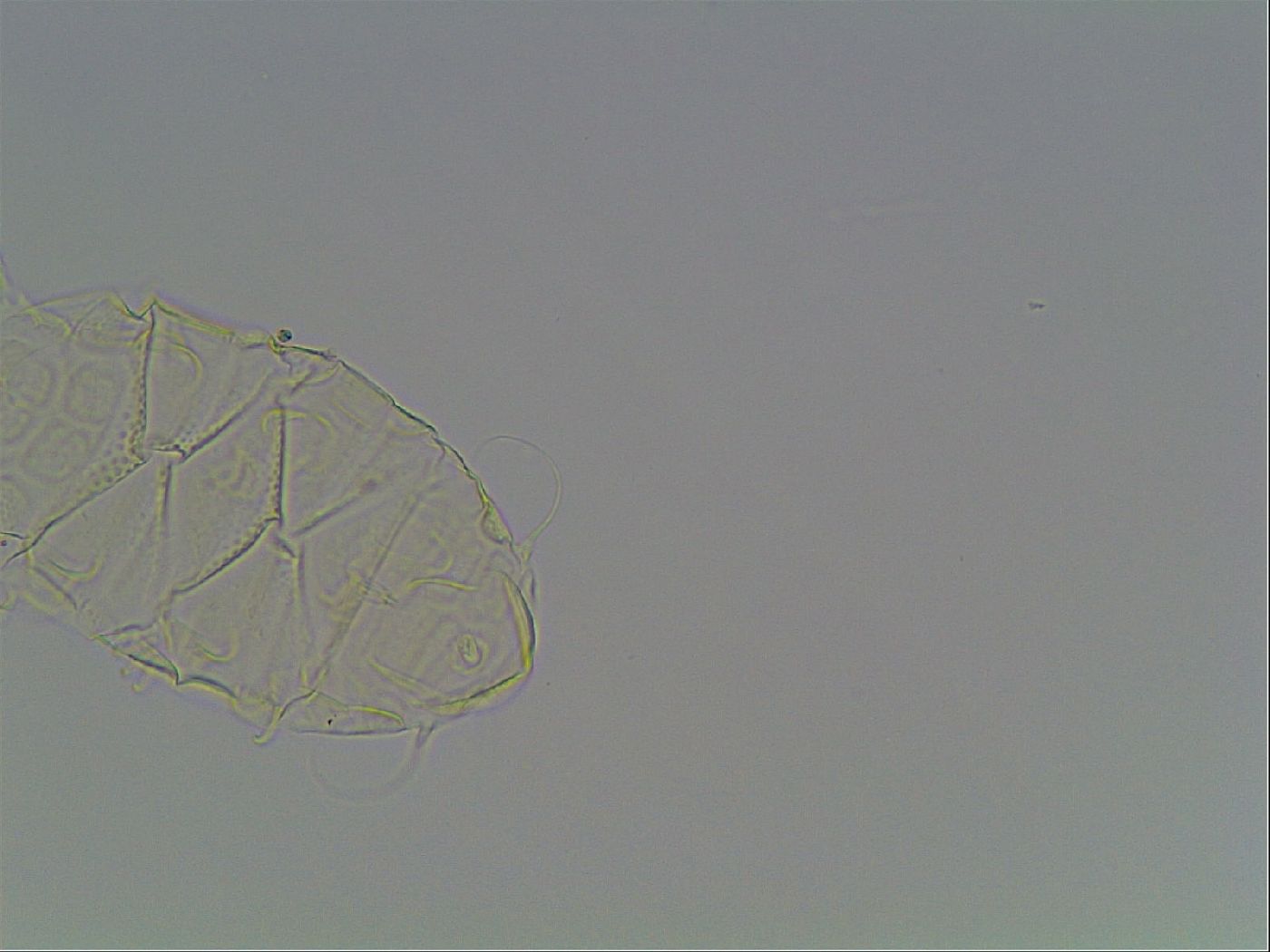 Echiniscus tessellatus image