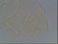 Echiniscus tessellatus image