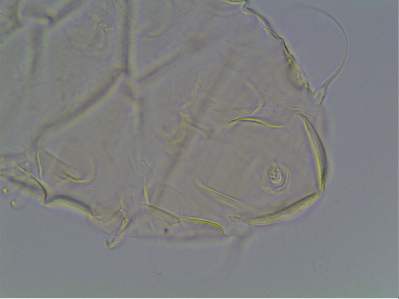 Echiniscus tessellatus image