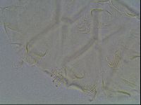 Echiniscus tessellatus image