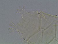 Echiniscus tessellatus image
