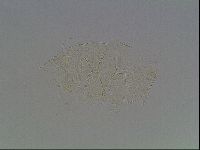 Echiniscus tessellatus image