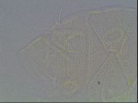 Echiniscus tessellatus image