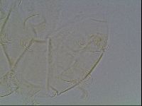 Echiniscus tessellatus image