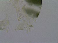 Echiniscus viridis image