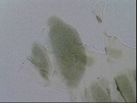 Echiniscus viridis image