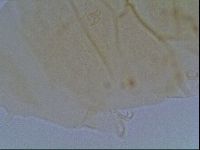 Echiniscus duboisi image