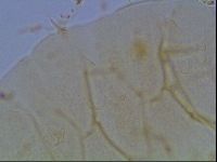 Echiniscus duboisi image