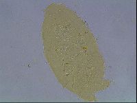 Echiniscus duboisi image