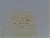 Echiniscus duboisi image