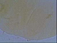 Echiniscus duboisi image