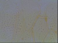 Echiniscus duboisi image