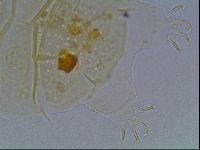 Echiniscus duboisi image