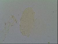 Echiniscus robertsi image