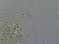 Echiniscus becki image
