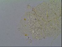 Echiniscus becki image