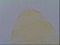 Echiniscus aliquantillus image