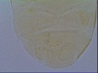 Media resource of Echiniscus aliquantillus