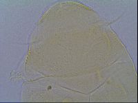 Echiniscus aliquantillus image