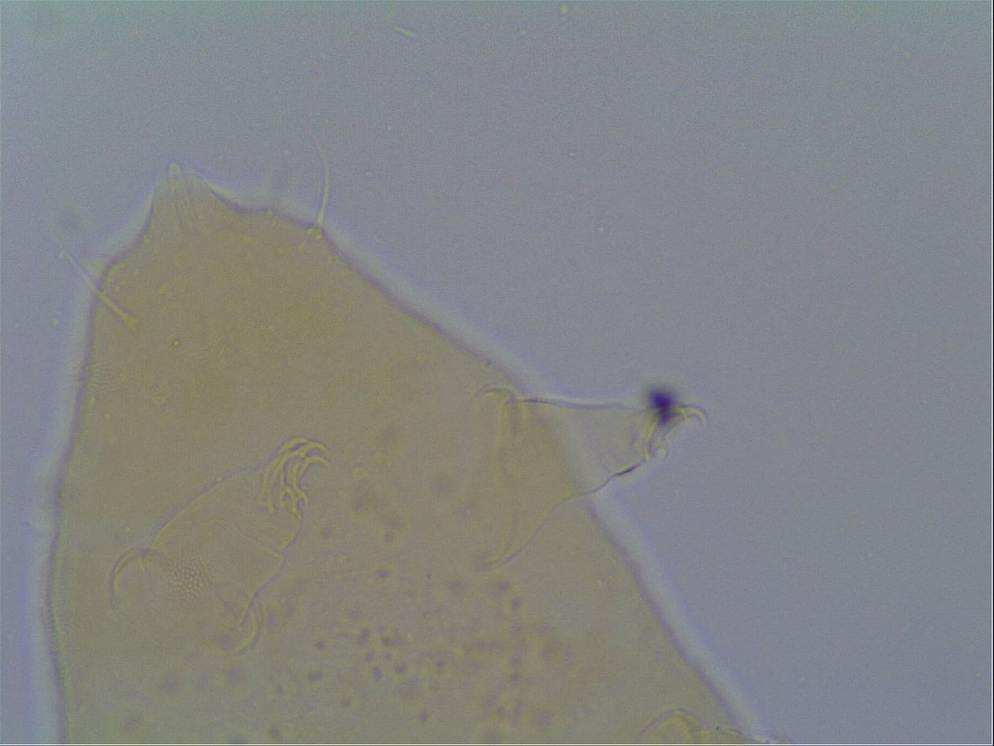Hypechiniscus exarmatus image