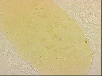 Bryodelphax crossotus image