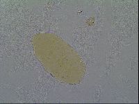 Bryodelphax crossotus image
