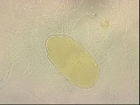 Bryodelphax crossotus image