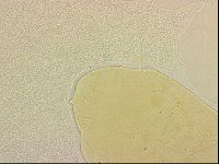 Bryodelphax crossotus image
