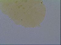 Media resource of Bryodelphax crossotus