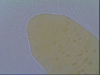 Bryodelphax crossotus image