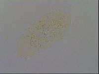 Echiniscus pseudelegans image