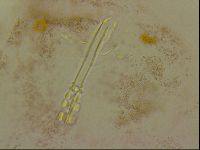 Haplomacrobiotus hermosillensis image