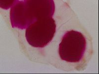 Haplomacrobiotus hermosillensis image