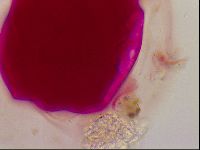 Haplomacrobiotus hermosillensis image