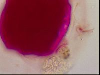 Haplomacrobiotus hermosillensis image