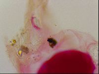 Haplomacrobiotus hermosillensis image