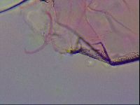 Haplomacrobiotus hermosillensis image